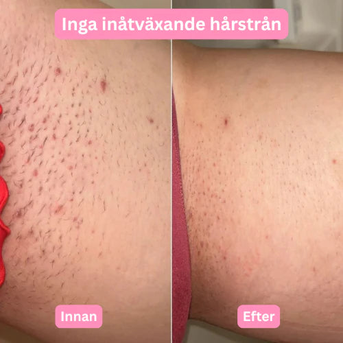 Charmella Silksafe™ – Len hud utan irritation